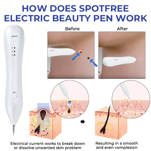 Oveallgo™ Spotfree ULTRA Professional Electric Cosmetic Pen